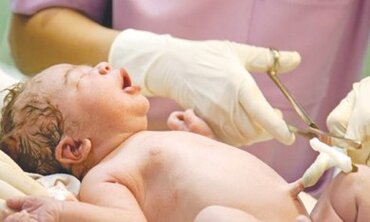 Những việc cần làm cho trẻ sơ sinh ngay sau đẻ