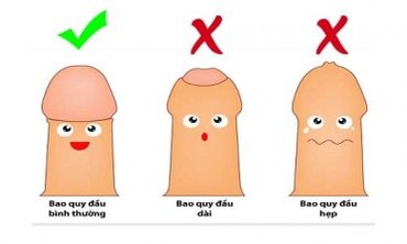 Hẹp bao quy đầu là gì?
