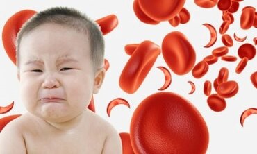 Những dấu hiệu cho thấy bé bị thiếu máu, thiếu sắt
