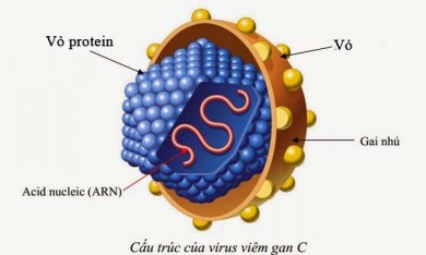 Viêm gan siêu vi B (HBV – Hepatitis Bvirus); viêm gan siêu vi C (HCV - Hepatitis C virus) 